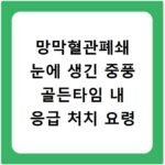 망막혈관폐쇄 눈에 생긴 중풍 골든타임 내 응급 처치 요령